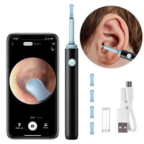 Smart Ear Cleaner with Camera & LED Light – Wireless Ear Wax Removal Tool