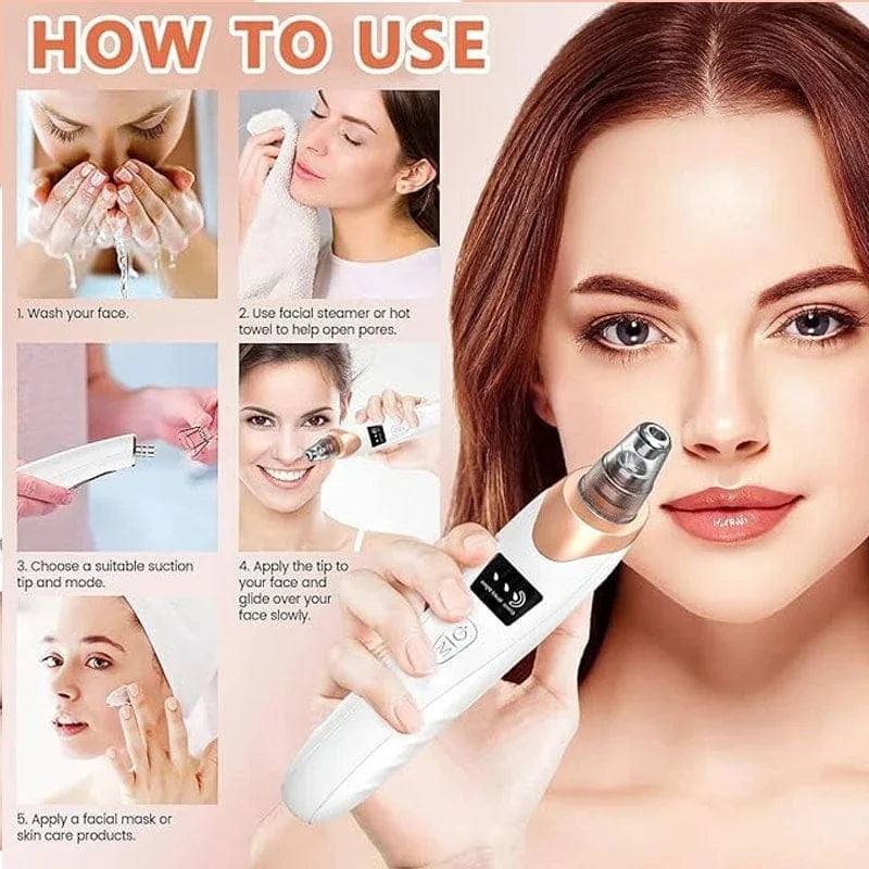 Electric Blackhead Remover Vacuum – 5-Head Pore Cleaner & Facial Suction Tool