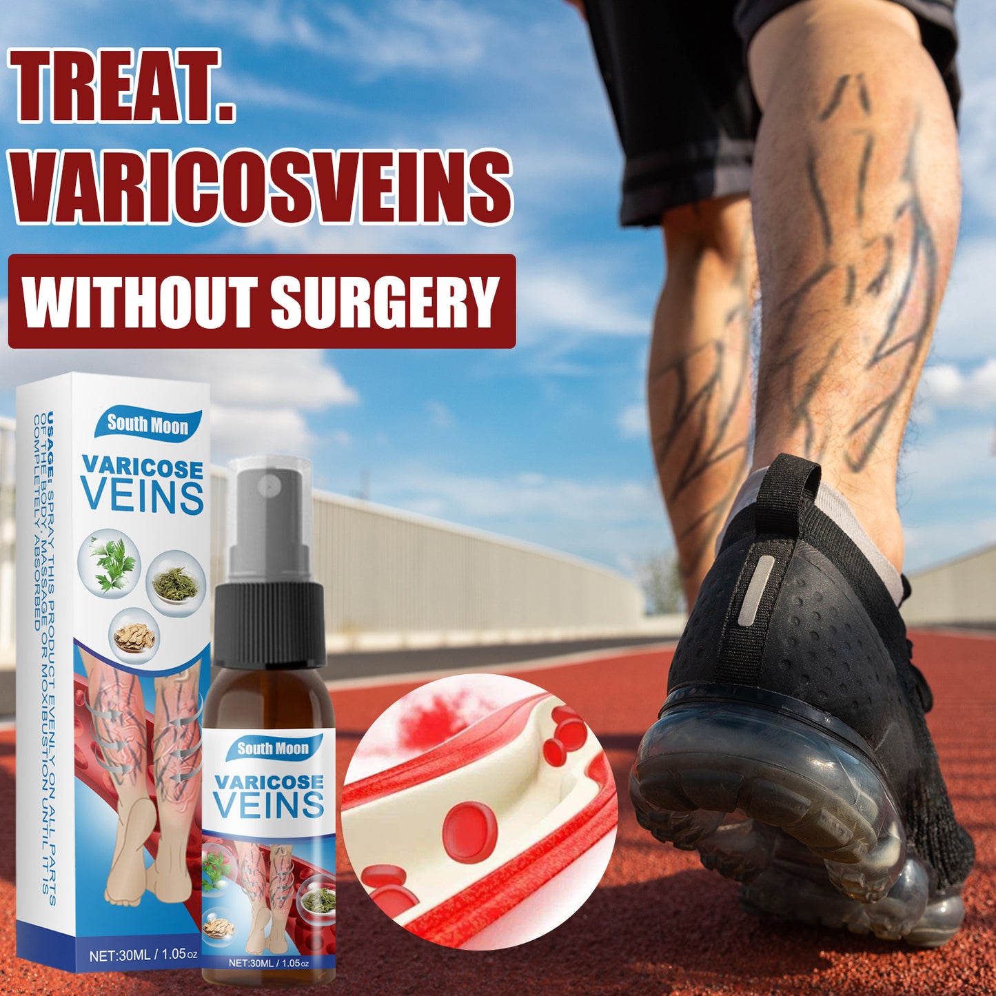 VenoRelief™ Varicose Vein Support Spray–Soothing Leg Care-30ml