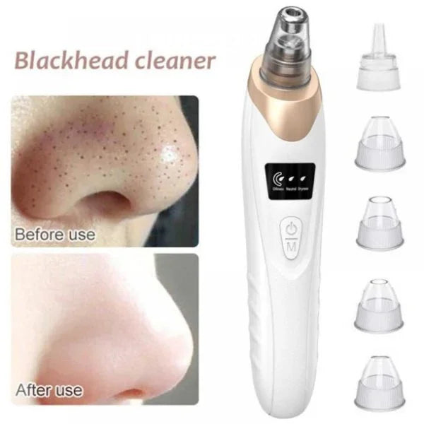 Electric Blackhead Remover Vacuum – 5-Head Pore Cleaner & Facial Suction Tool