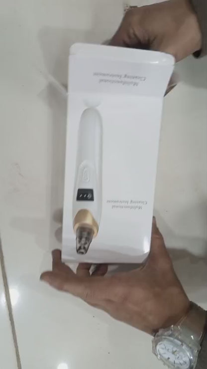Electric Blackhead Remover Vacuum – 5-Head Pore Cleaner & Facial Suction Tool